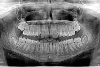 dental xray